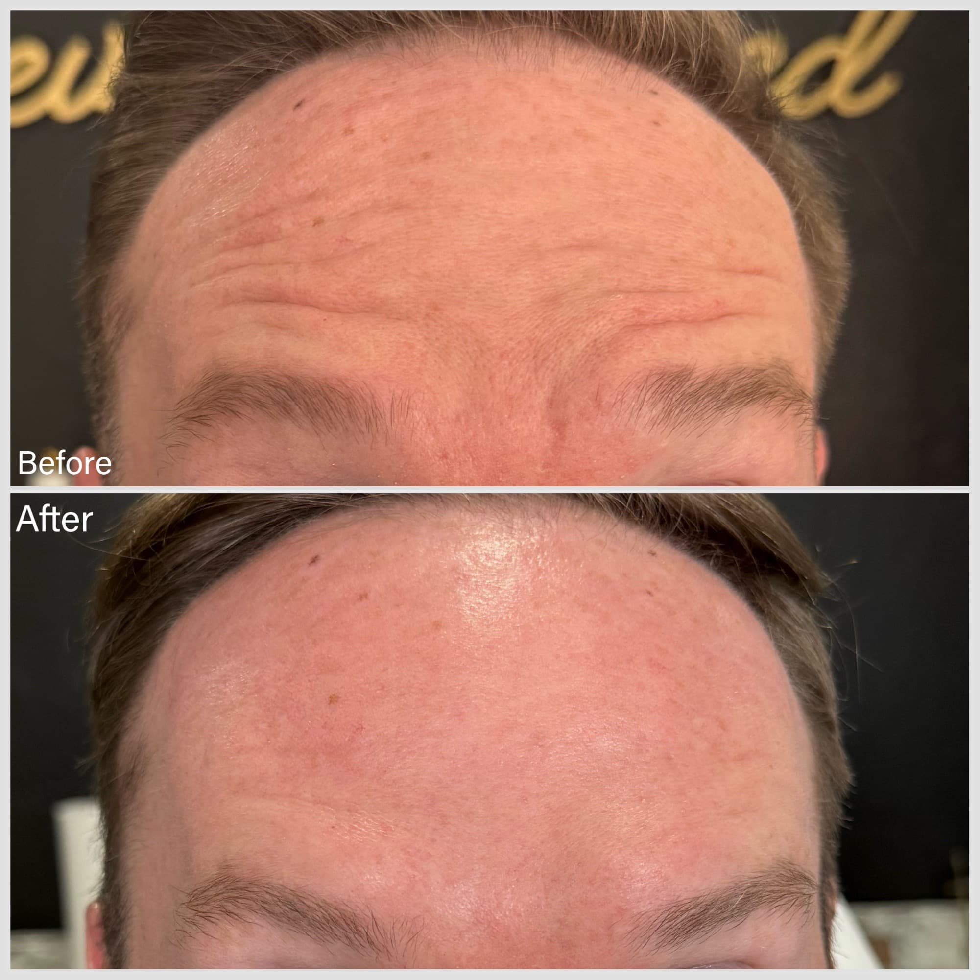 Before and after: Male before and after results of tox